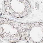 SLC27A4 Antibody in Immunohistochemistry (Paraffin) (IHC (P))