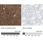 Glutamine Synthetase Antibody in Immunohistochemistry (Paraffin) (IHC (P))