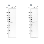 Glutamine Synthetase Antibody in Western Blot (WB)