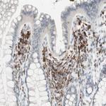 HPK1 Antibody in Immunohistochemistry (Paraffin) (IHC (P))