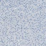 HPK1 Antibody in Immunohistochemistry (Paraffin) (IHC (P))