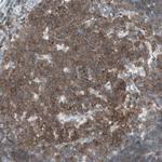 HPK1 Antibody in Immunohistochemistry (Paraffin) (IHC (P))