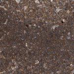 ROCK1 Polyclonal Antibody