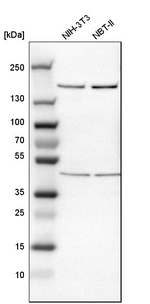 ROCK1 Antibody in Western Blot (WB)