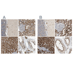 ACAT1 Antibody in Immunohistochemistry (Paraffin) (IHC (P))
