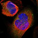 Glutamine Synthetase Polyclonal Antibody