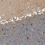 Glutamine Synthetase Antibody in Immunohistochemistry (Paraffin) (IHC (P))