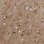 Glutamine Synthetase Antibody in Immunohistochemistry (Paraffin) (IHC (P))