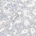 Glutamine Synthetase Antibody in Immunohistochemistry (Paraffin) (IHC (P))