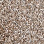 PHYH Polyclonal Antibody