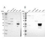 PHYH Antibody in Western Blot (WB)