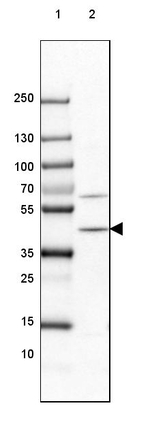 PHYH Antibody in Western Blot (WB)