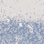 JMJD2A Antibody in Immunohistochemistry (Paraffin) (IHC (P))