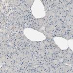 JMJD2A Antibody in Immunohistochemistry (Paraffin) (IHC (P))