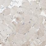 JMJD2A Antibody in Immunohistochemistry (Paraffin) (IHC (P))