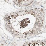 JMJD2A Antibody in Immunohistochemistry (Paraffin) (IHC (P))