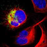 IL18R1 Polyclonal Antibody