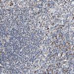 IL18R1 Antibody in Immunohistochemistry (Paraffin) (IHC (P))