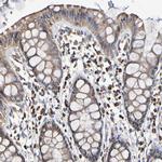 IL18R1 Antibody in Immunohistochemistry (Paraffin) (IHC (P))