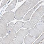 IL18R1 Antibody in Immunohistochemistry (Paraffin) (IHC (P))