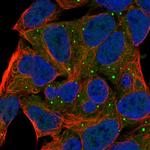 cGKI Polyclonal Antibody