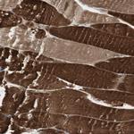 cGKI Antibody in Immunohistochemistry (Paraffin) (IHC (P))