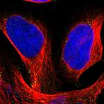 HGS Polyclonal Antibody