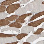 HGS Antibody in Immunohistochemistry (Paraffin) (IHC (P))