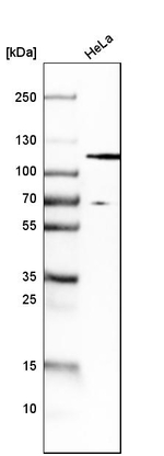 HGS Antibody in Western Blot (WB)