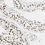 PRMT3 Polyclonal Antibody