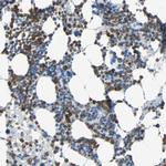 CLEC4A Antibody in Immunohistochemistry (Paraffin) (IHC (P))
