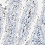 CLEC4A Polyclonal Antibody