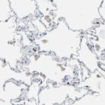 CLEC4A Antibody in Immunohistochemistry (Paraffin) (IHC (P))