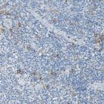 CLEC4A Antibody in Immunohistochemistry (Paraffin) (IHC (P))
