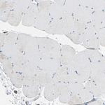 CLEC4A Antibody in Immunohistochemistry (Paraffin) (IHC (P))