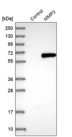 MMP3 Antibody in Western Blot (WB)