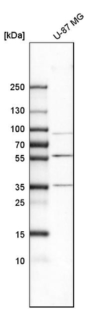 MMP3 Antibody in Western Blot (WB)