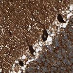 alpha-II Spectrin Antibody in Immunohistochemistry (Paraffin) (IHC (P))