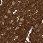 alpha-II Spectrin Antibody in Immunohistochemistry (Paraffin) (IHC (P))