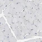 alpha-II Spectrin Antibody in Immunohistochemistry (Paraffin) (IHC (P))