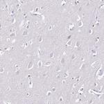 S100A4 Antibody in Immunohistochemistry (Paraffin) (IHC (P))