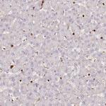 S100A4 Antibody in Immunohistochemistry (Paraffin) (IHC (P))
