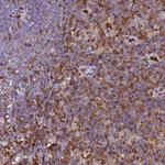 S100A4 Polyclonal Antibody