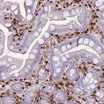 S100A4 Antibody in Immunohistochemistry (Paraffin) (IHC (P))