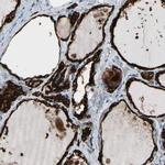 Thyroid Peroxidase Antibody in Immunohistochemistry (Paraffin) (IHC (P))