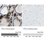 Thyroid Peroxidase Antibody
