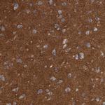 Ankyrin B Antibody in Immunohistochemistry (Paraffin) (IHC (P))