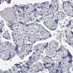 Ankyrin B Antibody in Immunohistochemistry (Paraffin) (IHC (P))