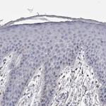 Ankyrin B Antibody in Immunohistochemistry (Paraffin) (IHC (P))