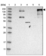 Ankyrin B Antibody in Western Blot (WB)